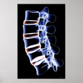 Lumbar Vertebrae Poster (Voorkant)