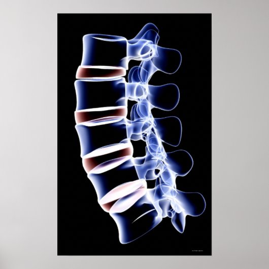 Lumbar Vertebrae Poster (Voorkant)
