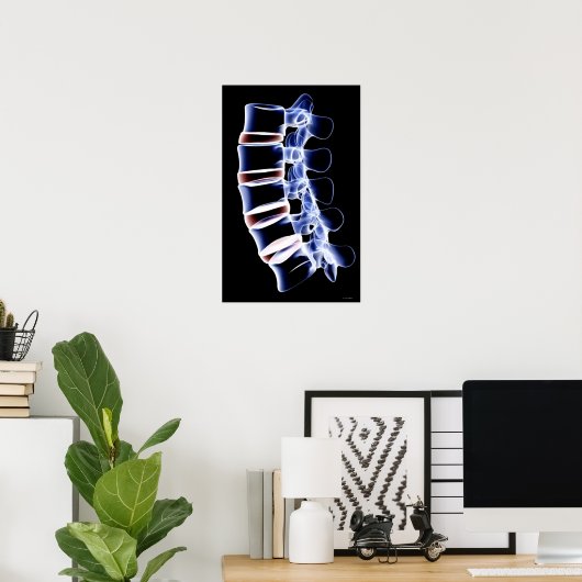 Lumbar Vertebrae Poster (Thuiskantoor)