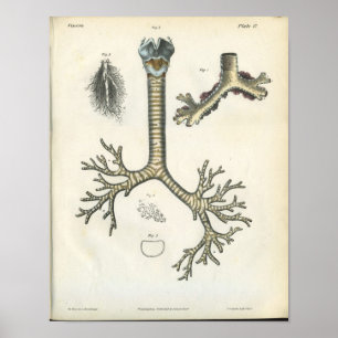 Lung Bronchi  Anatomie Print