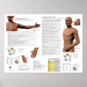 Lung Meridian Acupuncture Points Poster (Voorkant)