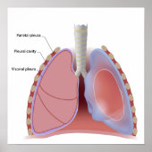 Lung pleura en Poster van de pleurale holte (Voorkant)