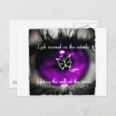 lupus eye22.jpg briefkaart (Voorkant / Achterkant)