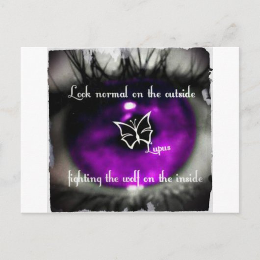 lupus eye22.jpg briefkaart (Voorkant)