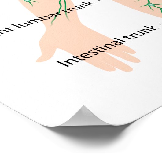 Lymfatische drainage met de vermelding poster (Hoek)