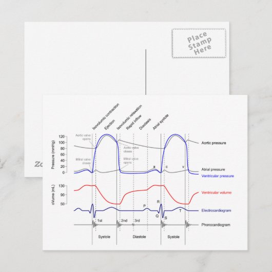 Maagdarmstelselaandoeningen linkerventrikel briefkaart (Voorkant / Achterkant)