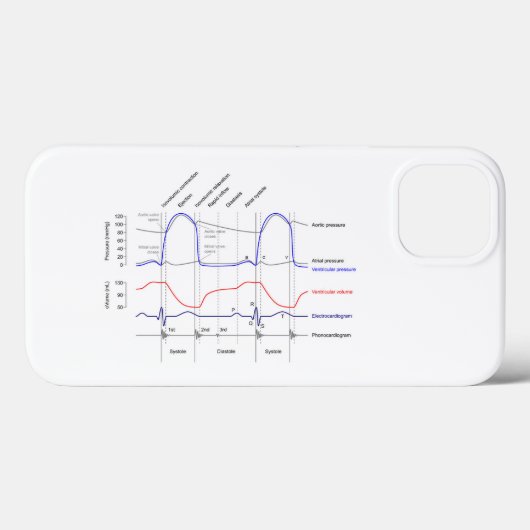 Maagdarmstelselaandoeningen linkerventrikel Case-Mate iPhone case (Achterkant (horizontaal))