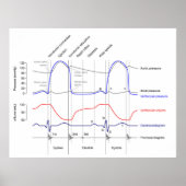 Maagdarmstelselaandoeningen linkerventrikel poster (Voorkant)