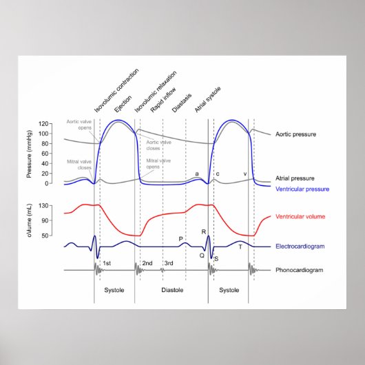 Maagdarmstelselaandoeningen linkerventrikel poster (Voorkant)