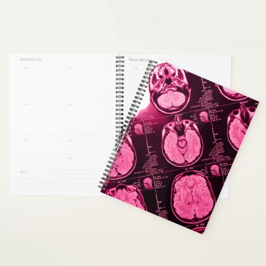 Magenta MRI: een axiaal Uitzicht van de hersenen Planner (Display)