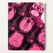 Magenta MRI: een axiaal Uitzicht van de hersenen Planner (Achterkant)