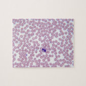 Malariële bloedcellen legpuzzel (Horizontaal)