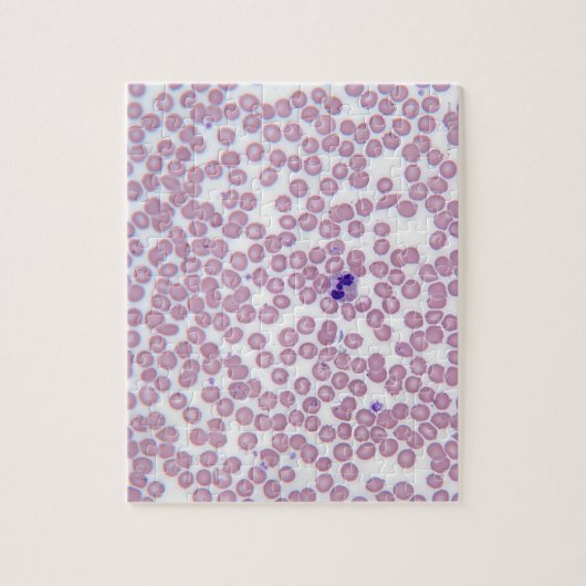 Malariële bloedcellen legpuzzel (Verticaal)