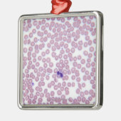 Malariële bloedcellen metalen ornament (Links)