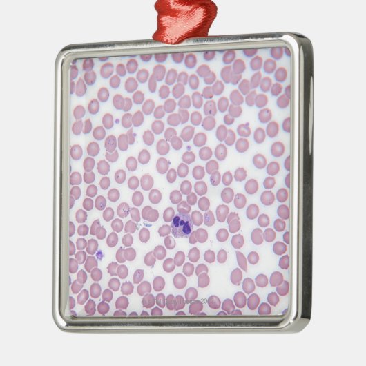 Malariële bloedcellen metalen ornament (Links)