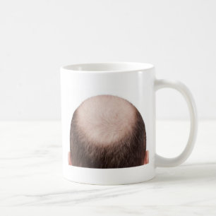 Mannelijke kaalheid koffiemok