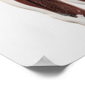 Mannelijke spierAnatomie van de menselijke benen,  Poster (Hoek)