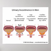 Mannelijke urine-incontinentie poster (Voorkant)