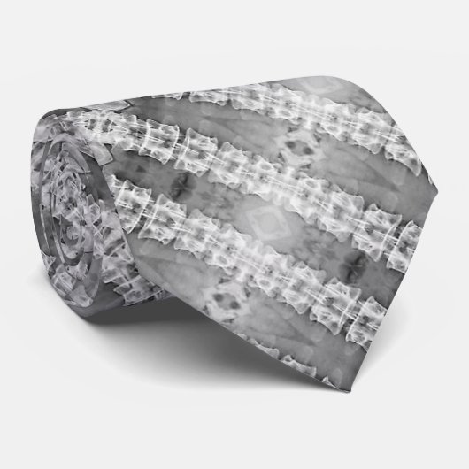 Mannen Stropdas wervelkolom Xray #2 (Opgerold)