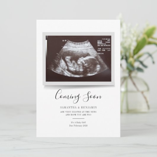 Manuscript Sonogram Binnenkort komt Zwangerschap A (Staand voorkant)