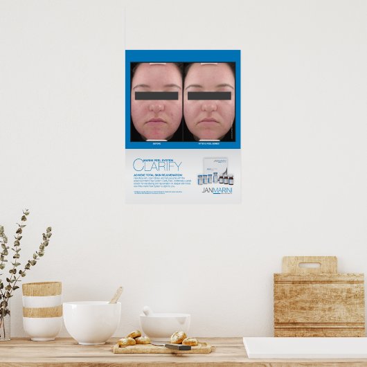 Marini Peel Clarify Resultaten 18x24" Poster (Keuken)