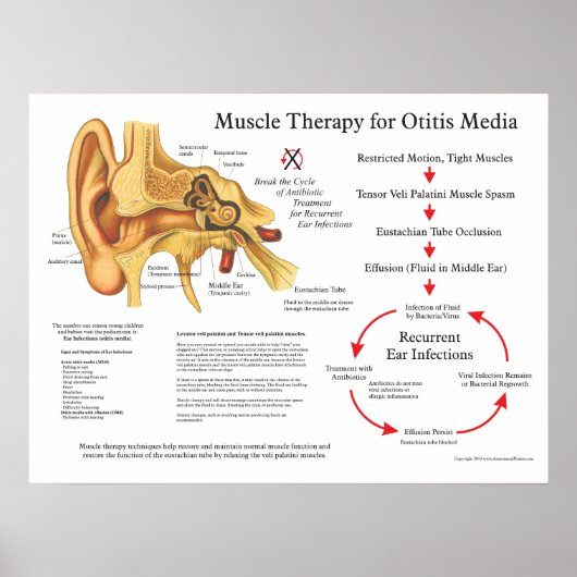 Massagetherapie voor de spieren bij otitis Media Poster (Voorkant)