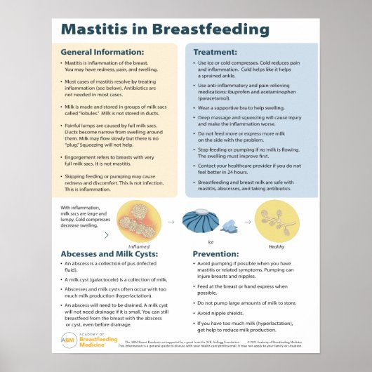 Mastitis in Borstvoeding Poster (Engels) (Voorkant)