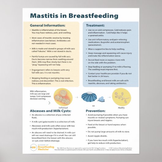 Mastitis in Borstvoeding Poster (Engels) (Voorkant)