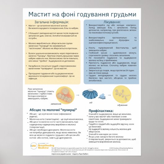 Mastitis in Borstvoeding Poster (Oekraïens) (Voorkant)