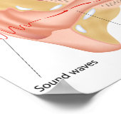 Mechanisme voor het horen van Poster (Hoek)