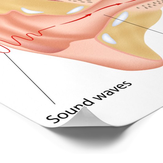 Mechanisme voor het horen van Poster (Hoek)