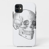 Medisch anatomische  schedel, monochroom Case-Mate iPhone case (Achterkant)