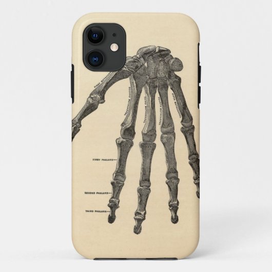 Medische anatomie handbotten iPhone hoes (Achterkant)