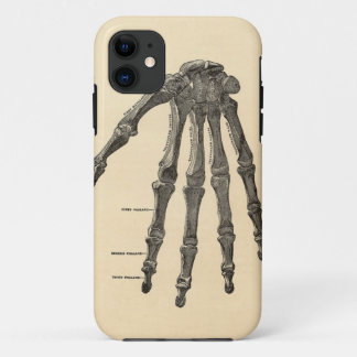 Medische anatomiehandse Botten iPhone Case