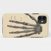 Medische anatomiehandse Botten iPhone Case (Achterkant (horizontaal))