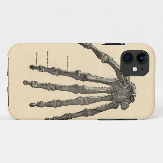 Medische anatomiehandse Botten iPhone Case (Achterkant (horizontaal))