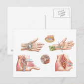 Medische illustratie met carpalettunnel briefkaart (Voorkant / Achterkant)