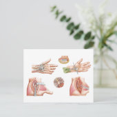 Medische illustratie met carpalettunnel briefkaart (Staand voorkant)