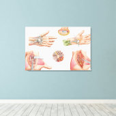Medische illustratie met carpalettunnel canvas afdruk (Insitu (Houten vloer))