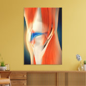 Medische illustratie: ontsteking bij knie canvas afdruk (Insitu (Woonkamer))