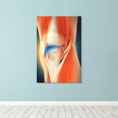 Medische illustratie: ontsteking bij knie canvas afdruk (Insitu (Houten vloer))