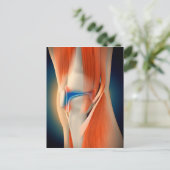 Medische Illustratie: Ontsteking in Knie Briefkaart (Staand voorkant)