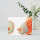 Medische illustratie van de borst van het Vrouw Briefkaart (Staand voorkant)