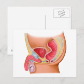 Medische illustratie van een recontrethrale fistel briefkaart (Voorkant / Achterkant)