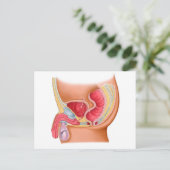 Medische illustratie van een recontrethrale fistel briefkaart (Staand voorkant)