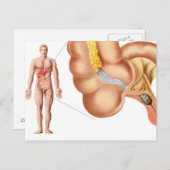 Medische isolatie van een aanhangsel briefkaart (Voorkant / Achterkant)