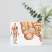 Medische isolatie van een aanhangsel briefkaart (Staand voorkant)