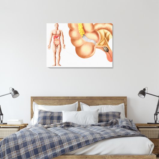 Medische isolatie van een aanhangsel canvas afdruk (Insitu (Slaapkamer))