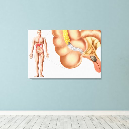 Medische isolatie van een aanhangsel canvas afdruk (Insitu (Houten vloer))