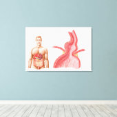 Medische isolatie van een Hiatale Hernia in de Canvas Afdruk (Insitu (Houten vloer))